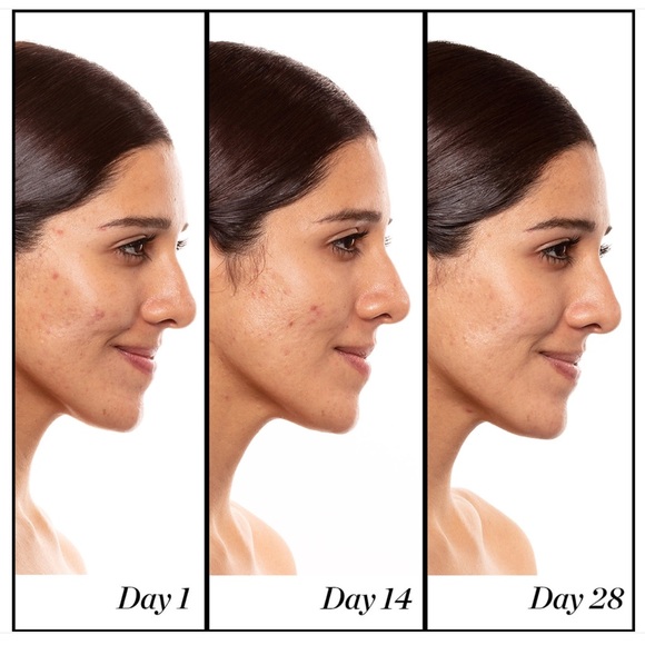 Sunday Riley A+ High-Dose Retinoid Serums - Picture 5 of 8